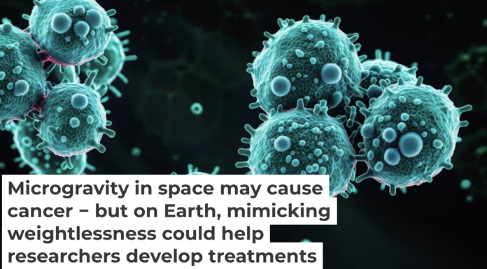 Cancer cells are more hardy in the low-gravity conditions of space. koto_feja/iStock via Getty Images Plus